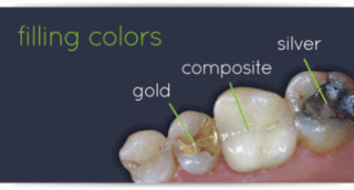 Composite Fillings in West New York