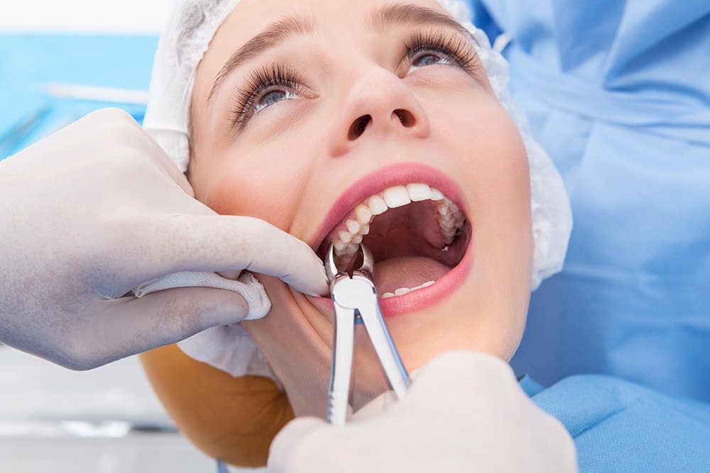 Tooth Extractions in West New York | Dentist in West New York, NJ 07093