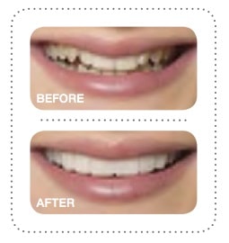 Snap On Smile in West New York