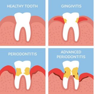 Periodontist in West New York